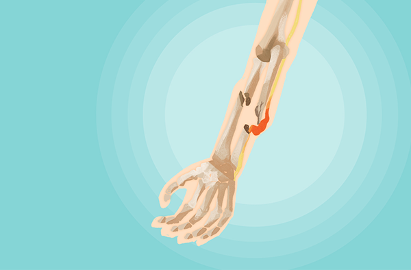 �������Ƶ�Σ�� �������Ƶ�Σ������Щ